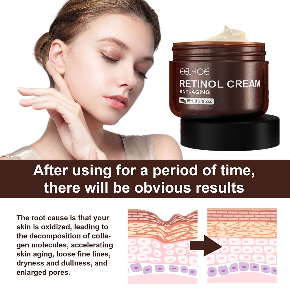 EELHOE 1/2/3/5PCS (Compre 3 y  - Retinol Cream reseña y precio